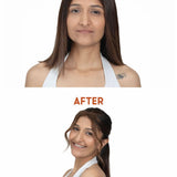 Before and after