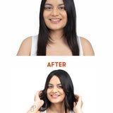 Before and after