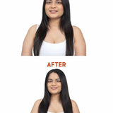 Before and after