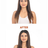 Before and after