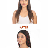 Before and after