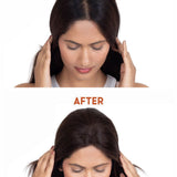 Before and after