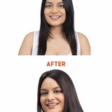 Before and after