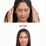 Before and after