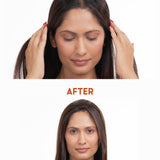 Before and after