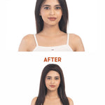 Before and after