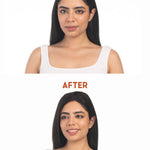 Before and after