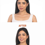 Before and after