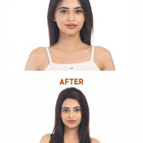 Before and after