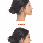 Before and after
