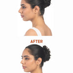 Before and after