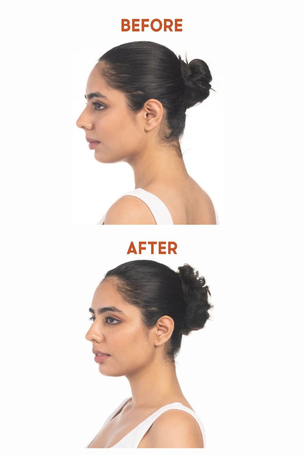 Before and after