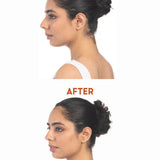 Before and after