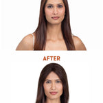 Before and after
