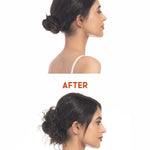 Before and after