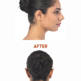 Before and after