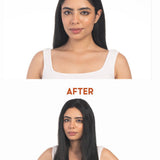 Before and after