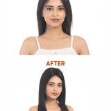 Before and after