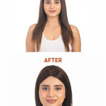 Before and after