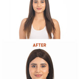 Before and after