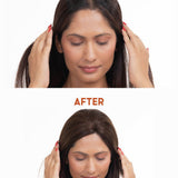 Before and after